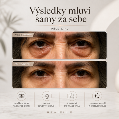 Revielle: 2v1 terapie červeným světlem + EMS pro odstranění očních váčků